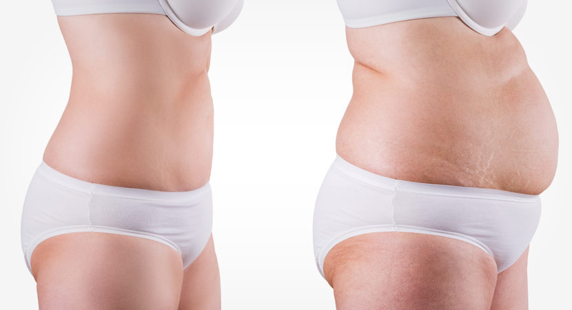 Blue Cosmetic Clinic, Non-Surgical Fat Reduction in Richmond Hill