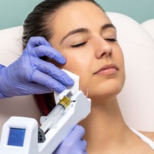 Mesotherapy in Richmond Hill